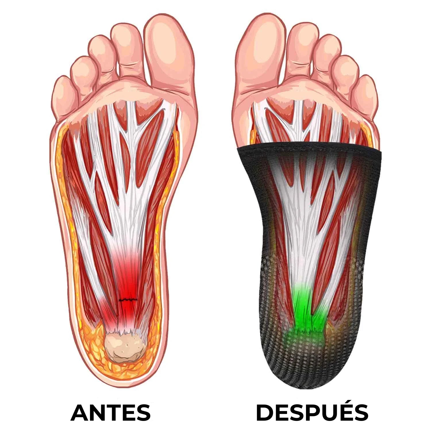 Therapie Manga para Pie
